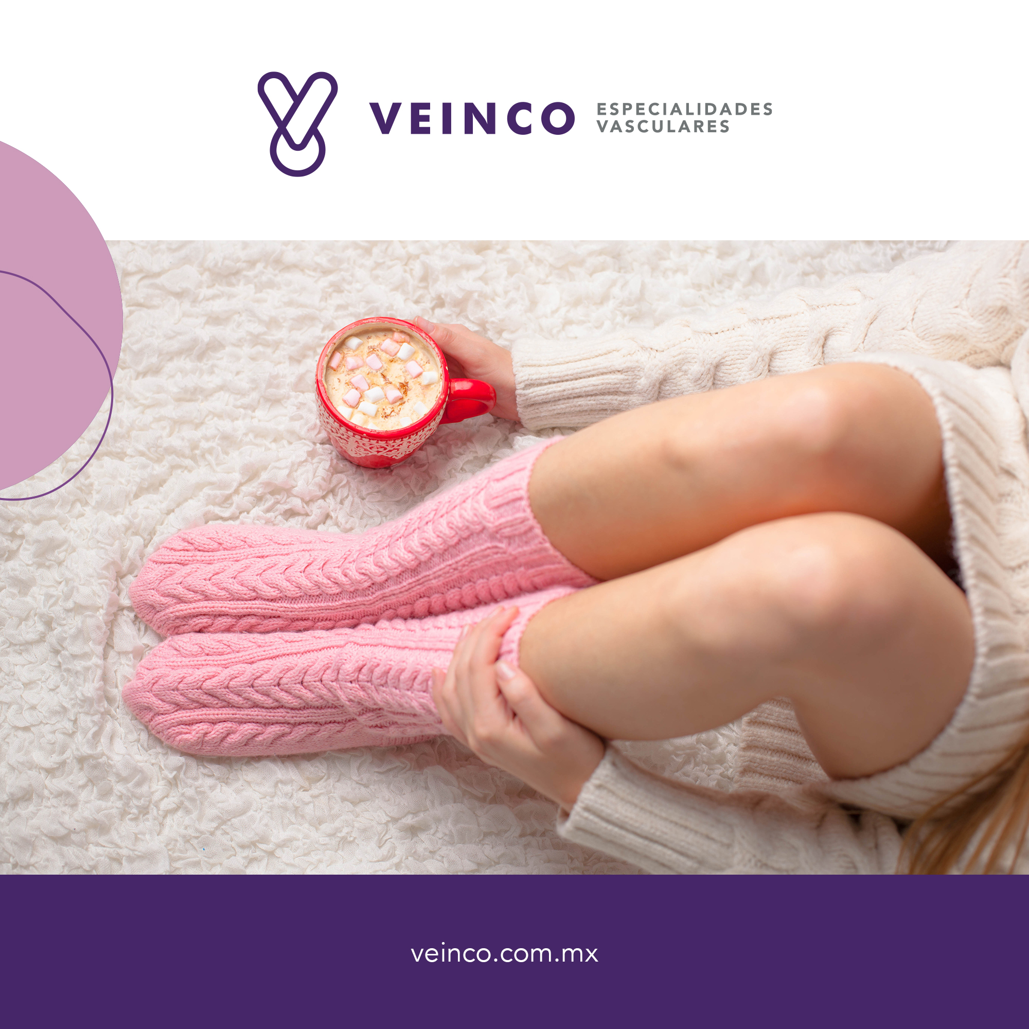 Varicose Vein Symptoms