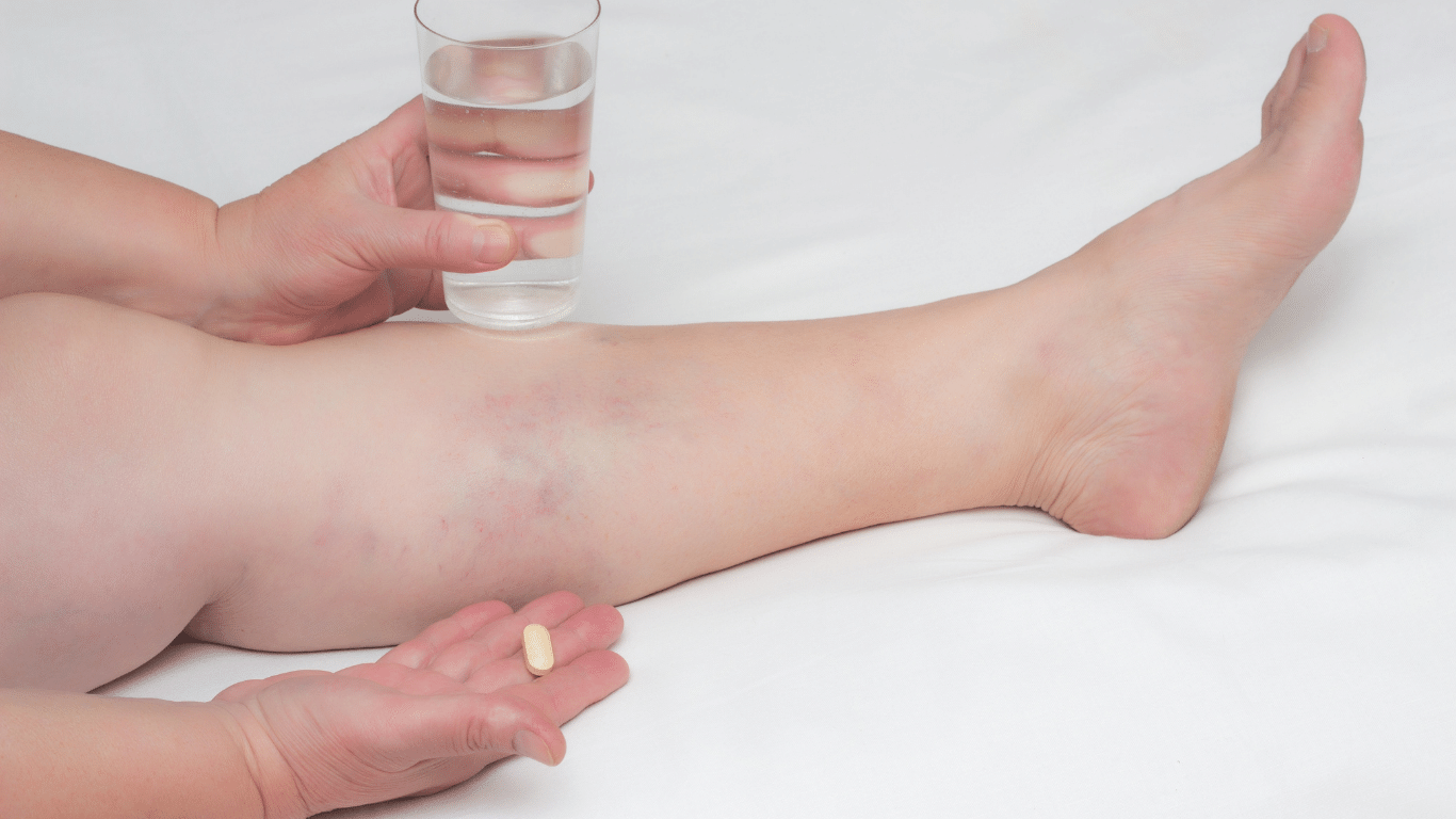 Venous insufficiency is a disease process which can affect all age